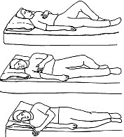 Lumbar Spine - Post Surgery Care (Inpatient)